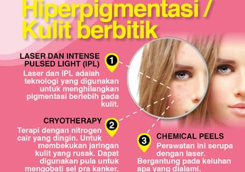 3 Solusi Medis Untuk Kulit Berbintik atau Hiperpigmentasi