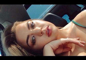 Nggak Nyangka, Ini Akibatnya Kalau Kalian Suka Pencet Jerawat!