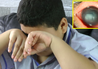 Setelah Berenang Mata Anak Ini Infeksi, Dokter Bilang Dia Nyaris Buta, Setelah Diselidiki Ternyata Ini Penyebabnya