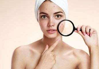 Ternyata Ini yang Sebabkan Wanita Berjerawat, Sepele?