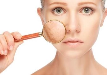 Warna Kulit Berubah? Ternyata Ini Penyebabnya, Mungkin Kamu Alami Salah satunya