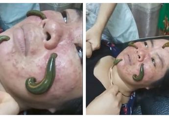 Berani Banget! Seorang Perempuan Pake Hewan Ini untuk Sembuhkan Jerawat, Lihat Videonya!