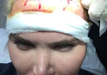 Mengerikan! Pria Ini Habiskan Rp 341 Juta Cuma Buat Bikin Rambutnya Seperti Ini