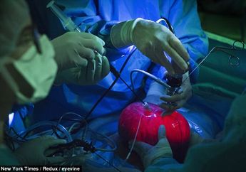 Siapa Sangka Bulatan Merah Bercahaya Ini Adalah Rahim di Luar Tubuh Seorang Ibu, Ternyata Ini yang Terjadi