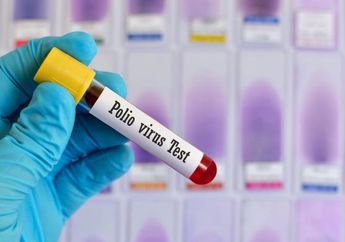 Ini yang Harus Kamu Tahu Tentang Polio dan Cara Penanganannya