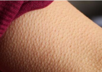 Pernah Merinding Saat Dengar Lagu? Ternyata Ini Artinya...