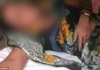 Tolak Layani Suaminya, Wanita Ini Disiram dengan Cairan Kimia di Bagian Sensitif Tubuhnya hingga Terjadi Hal Mencengangkan Ini