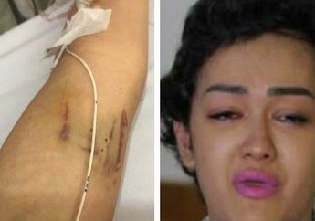 Dibalik Kekuatannya, Julia Perez Ternyata Sering Menangis di Kamar Rumah Sakit