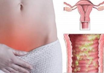 Kamu Bisa loh Obati Bakteri pada Miss V, Caranya Sangat Mudah!