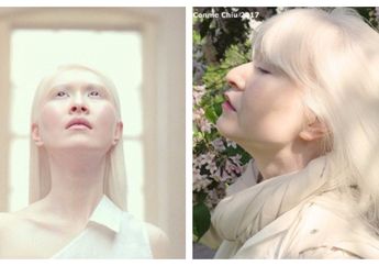 Wow, Dilahirkan Berbeda, Perempuan Ini Jadi Model Albino Pertama di Dunia, Ternyata Awalnya Begini