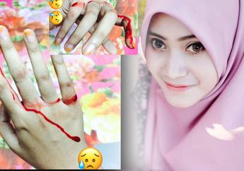 VIRAL : Bangun Tidur, Jari Tangan Wanita ini Sudah Penuh Darah, Astaga Ternyata Hewan ini Penyebabnya