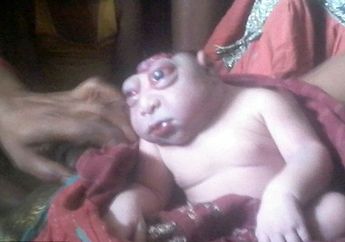 Khalida Begum Menolak Menyusui Anak yang Ia Lahirkan karena Seperti Alien