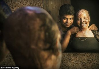 Lihatlah Kondisi Wanita Ini, Pasangannya Membuktikan Cinta Itu Buta dan Cinta Sejati Itu Ada di Dunia Ini