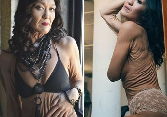 Hati-hati, Ternyata Ada Sindrom yang Bisa Buat Kulitmu Tampak Tua Hingga Organ Bagian Dalam Tubuhmu Pecah! Ini Penjelasannya