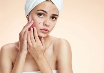 Nggak Mau Jerawat Datang Lagi, yuk Intip Cara Mudah Mencegahnya!