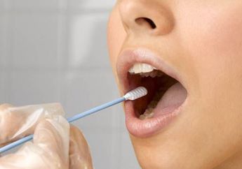 Jangan Remehkan Sakit Gusi Karena Bakteri, Ternyata Bisa Sebabkan Berbagai Masalah Kesehatan Lainnya, Nomor 2 Serem Banget!