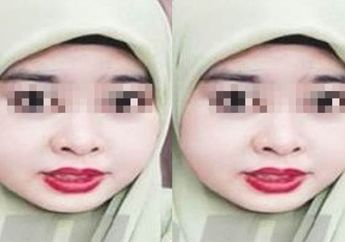 Ngeri! Wajah Wanita Ini Bengkak setelah Menggunakan Kosmetik!