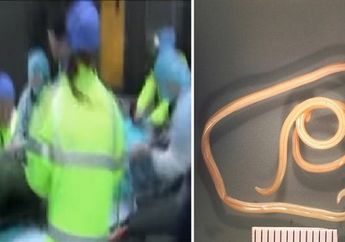 Langka, Dokter Temukan Cacing Gelang Sepanjang 28 Cm di Tubuh Tentara Korea Utara yang Melarikan Diri