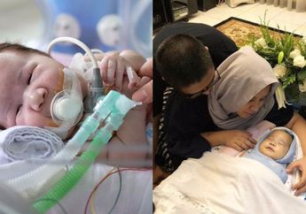Kisah Hidup Adam Fabumi, Bayi Lucu Pengidap Trisomy 13 yang Jadi Inspirasi Semua Orang, Kini Telah Berpulang