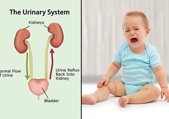 Dari Perubahan Selera Makan Pada Bayi Sampai Muntah, Mungkin Penyakit Ini yang Dia Alami