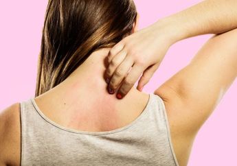 Nggak Nyangka! Hal Ini Ternyata Bisa Sebabkan Psoriasis, Salah Satunya Kamu Banget nih!