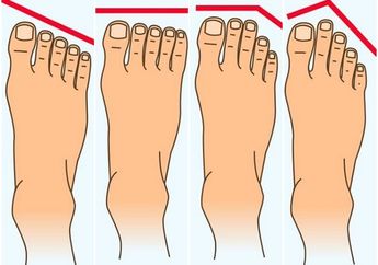 Cari Tahu Kepribadian Seseorang dari Bentuk Kaki, Kalau Kamu yang Mana? 