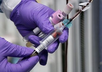 Golongan Darah Punya Pengaruh Terhadap Risiko Stroke