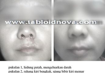 Curhat Istri Korban KDRT (2)