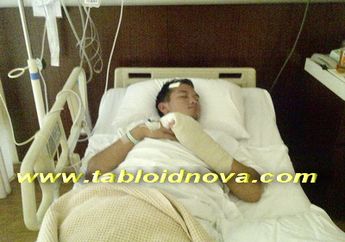 Hampir Pulih, Rezky Aditya Mulai Belajar Jalan