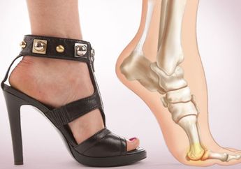 Kaum Wanita, Hati-hati Saat Memakai High Heels!