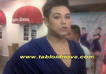 Ivan Gunawan Jalani Operasi Sedot Lemak