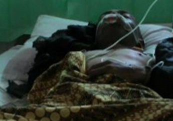 Siswa SMA Ini Muntah Darah Dihukum Benturkan Dahi 800 Kali ke Meja