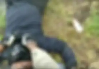 Tabrak Pagar Kuburan, Tulang Bahu Pemotor Patah, Begini Cara Menolong Korban Kecelakaan