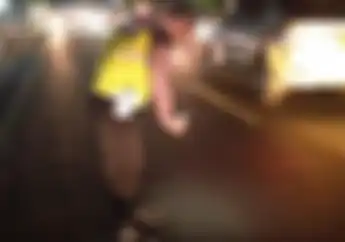 Kurang Hati-hati Saat Menyeberang, Ibu Hamil Luka Parah Dihantam Kawasaki Ninja 250