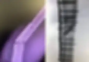 Ngilu Lihatnya, Beredar Foto Kondisi Pelat Titanium Tangan Marc Marquez Yang Patah