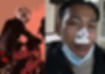 Hidung Luka Bibir Dijahit, Bripka Firman Terseret Motor Saat Lawan Kawanan Penjahat