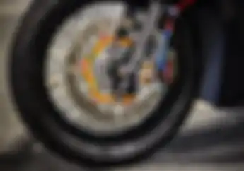 Awas, Bukannya Keren Ubah Pelek Jadi Lebih Besar Malah Jadi Masalah
