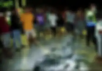 Yamaha Free Go Hangus Terbakar, Pemotor Tidak Fokus Karena Anjing Liar