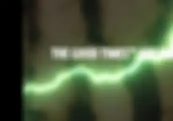 Teaser Motor Listrik Kawasaki Beredar, Tipe Motor Trail Untuk Anak-Anak?