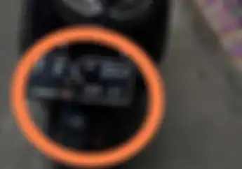 Satu Lagi Korban Dudukan Pelat Nomor Yamaha NMAX Jungkir Balik Engsel Bahu Kiri Hampir Lepas Fatal