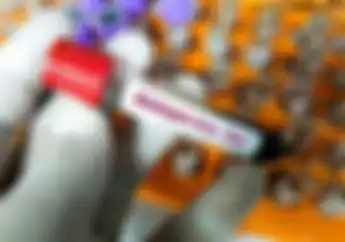 Bikers Waspadalah Suspek Cacar Monyet Muncul Di Jawa Tengah, Begini Gejalanya