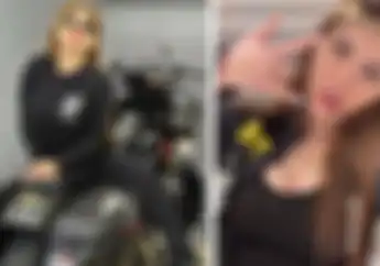 Selebgram Seksi Penyuka Moge Angela Lee Kecelakaan, Kaki Kanan Luka Parah