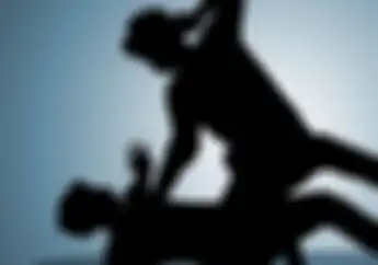 Badan Kesenggol Motor, Pria di Setiabudi Jaksel Alami Patah Kaki