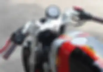 Niat Pasang Setang Jepit? Baca Dulu Informasi Ini