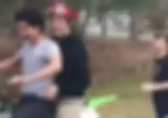 Gokil! Video Cabut Gigi Pakai Motor Trail, Gimana Rasanya Nih?
