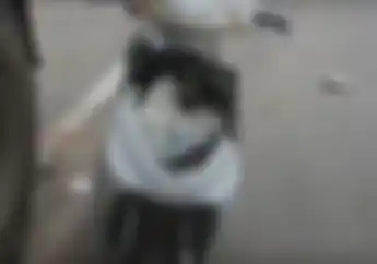 Lihat deh Video Ini, Main Hp Sambil Naik Motor Wajah Dijahit 30 Jahitan