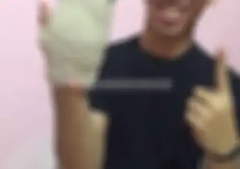 Gerry Salim Patah Tulang Metacarpal