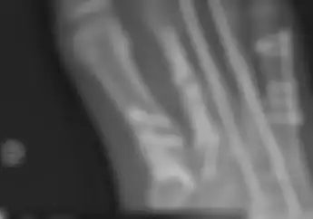 Titanium Di Kaki Kanan Loris Baz