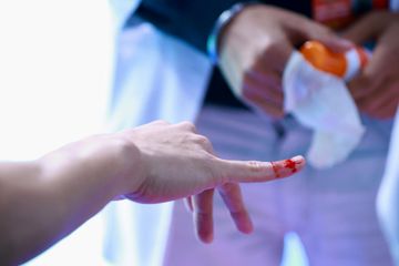 Tangan dari Jonatan Christie berdarah di tengah laga babak 16 besar India Open 2026, Kamis (15/1/2026)