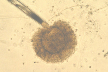 Aspergillus tubingensis